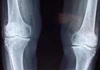 Radiation Therapist Job Description