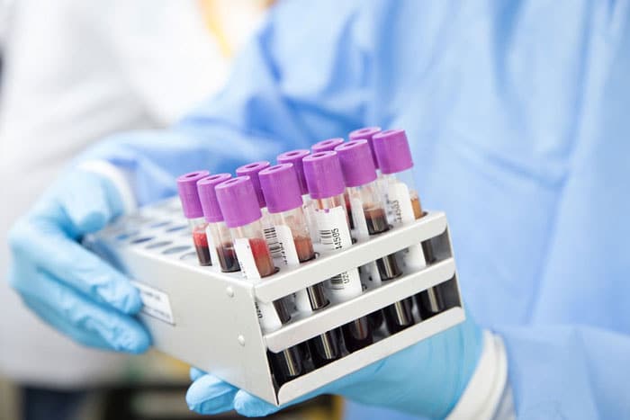 Blood Spatter Analyst Job Description